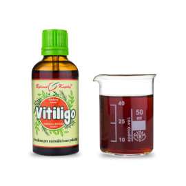 Nedostatečná pigmentace (Vitiligo) kapky (tinktura) 50 ml